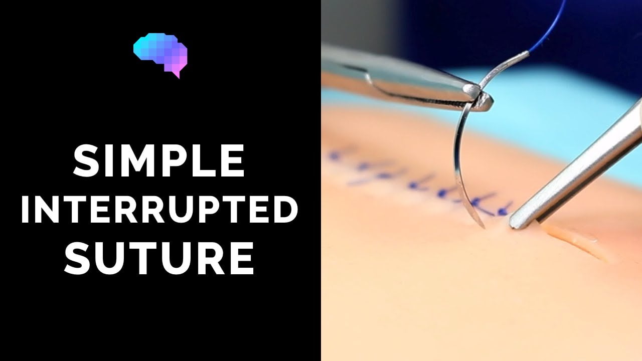 Simple interrupted suturing technique