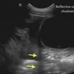 Atlas Of Small Animal Ultrasonography 2nd Edition (Videos Screenshot) 02