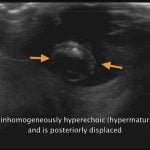 Atlas Of Small Animal Ultrasonography 2nd Edition (Videos Screenshot) 03