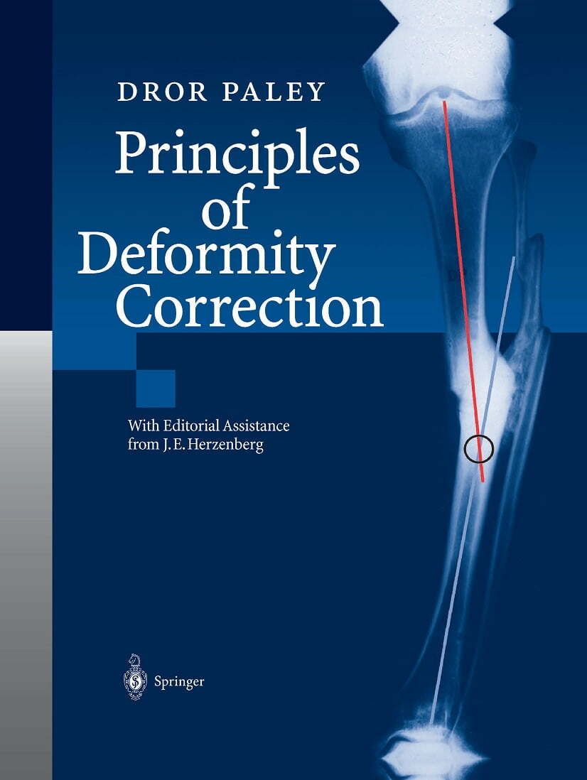 Principles Of Deformity Correction PDF