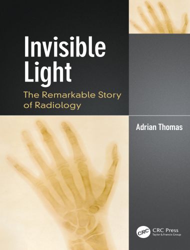 Invisible light the remarkable story of radiology