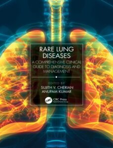 Rare lung diseases a comprehensive clinical guide to diagnosis and management