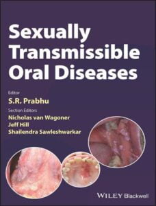 Sexually transmissible oral diseases pdf
