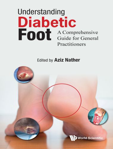 Understanding diabetic foot a comprehensive guide for general practitioners